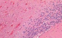 Neuritin Antibody, Novus Biologicals 50 &mu;g | Buy Online | Novus Biologicals | Fisher Scientific